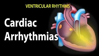 Cardiac Arrhythmias Animation [upl. by Kinchen]