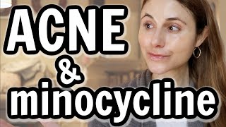 Minocycline versus doxycycline for acne Dr Dray [upl. by Leamhsi]