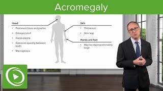 Acromegaly – Endocrinology  Lecturio [upl. by Benisch]