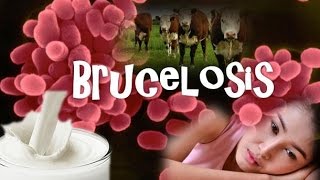 Brucelosis Brucella [upl. by Weide]