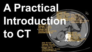 A Practical Introduction to CT [upl. by Antonino]