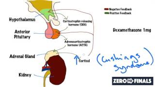 Understanding The Dexamethasone Suppression Test [upl. by Phio]