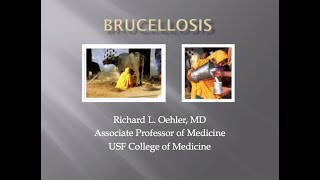 Brucellosis  Richard Oehler MD [upl. by Caria198]