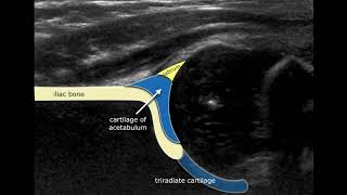 Hip Anatomy Animated Tutorial [upl. by Naujet686]