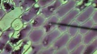 Onion Cells Plasmolysis [upl. by Crenshaw]