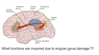 PROSOPAGNOSIA Face blindnessANGULAR GYRUS LESIONS [upl. by Ailyn302]