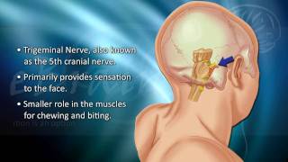 Understanding Trigeminal Neuralgia  eBrainMDcom [upl. by Nelleeus560]