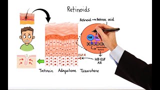 Pharmacology  ACNE TREATMENTS MADE EASY [upl. by Eelana]